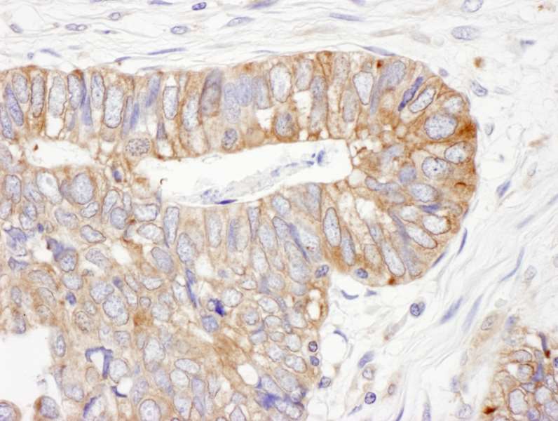 PDIA6 / ERP5 Antibody (aa250-300)