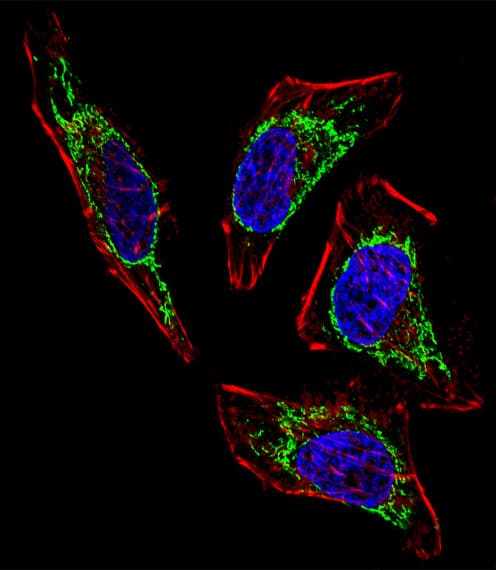 HSPD1 / HSP60 Antibody (aa187-215)