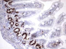 MKI67 / Ki67 Antibody (aa1160-1493, clone OTI13F12)