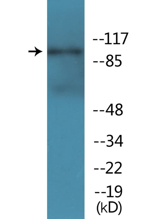 Polyclonal Rabbit anti-Human GRIN1 / NMDAR1 Antibody (phospho-Ser896, IHC, WB)