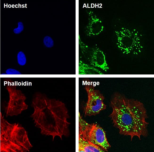 Monoclonal Mouse anti-Human ALDH2 Antibody (clone 4G6A3, Amino Acid: 317-517, IHC, IF, WB)