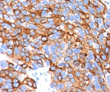 MLANA / Melan-A Antibody (clone A103 + M2-7C10 + M2-9E3, Ready-to-Use)