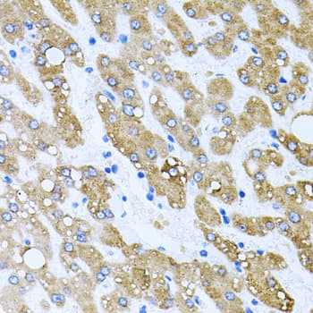 Polyclonal Rabbit anti-Human TOB2 Antibody (IHC, WB)