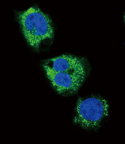 Polyclonal Rabbit anti-Human FGG / Fibrinogen Gamma Antibody (aa420-449, IHC, IF, WB)