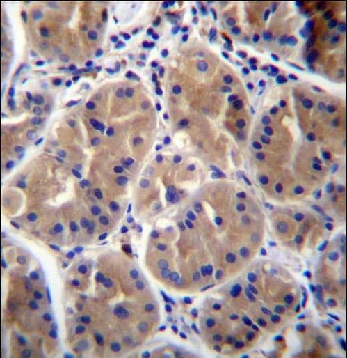 Polyclonal Rabbit anti-Human RAB27B Antibody (aa121-150, IHC, WB)