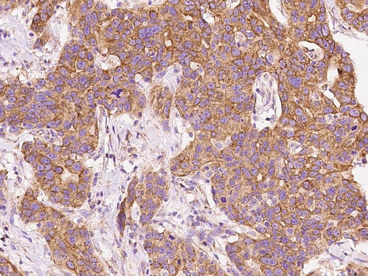 NIX / BNIP3L Antibody (Preservative Free)