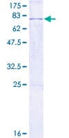 Human SPOCK1 / SPOCK / Testican Protein (Recombinant GST)