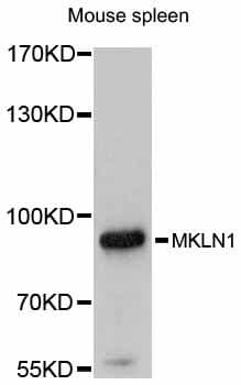Polyclonal Rabbit anti-Human MKLN1 / Muskelin Antibody (WB)