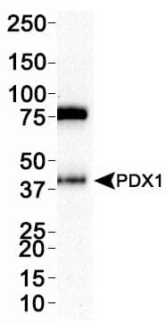Polyclonal Rabbit anti-Human PDX1 Antibody (aa100-200, IHC, IF, WB)