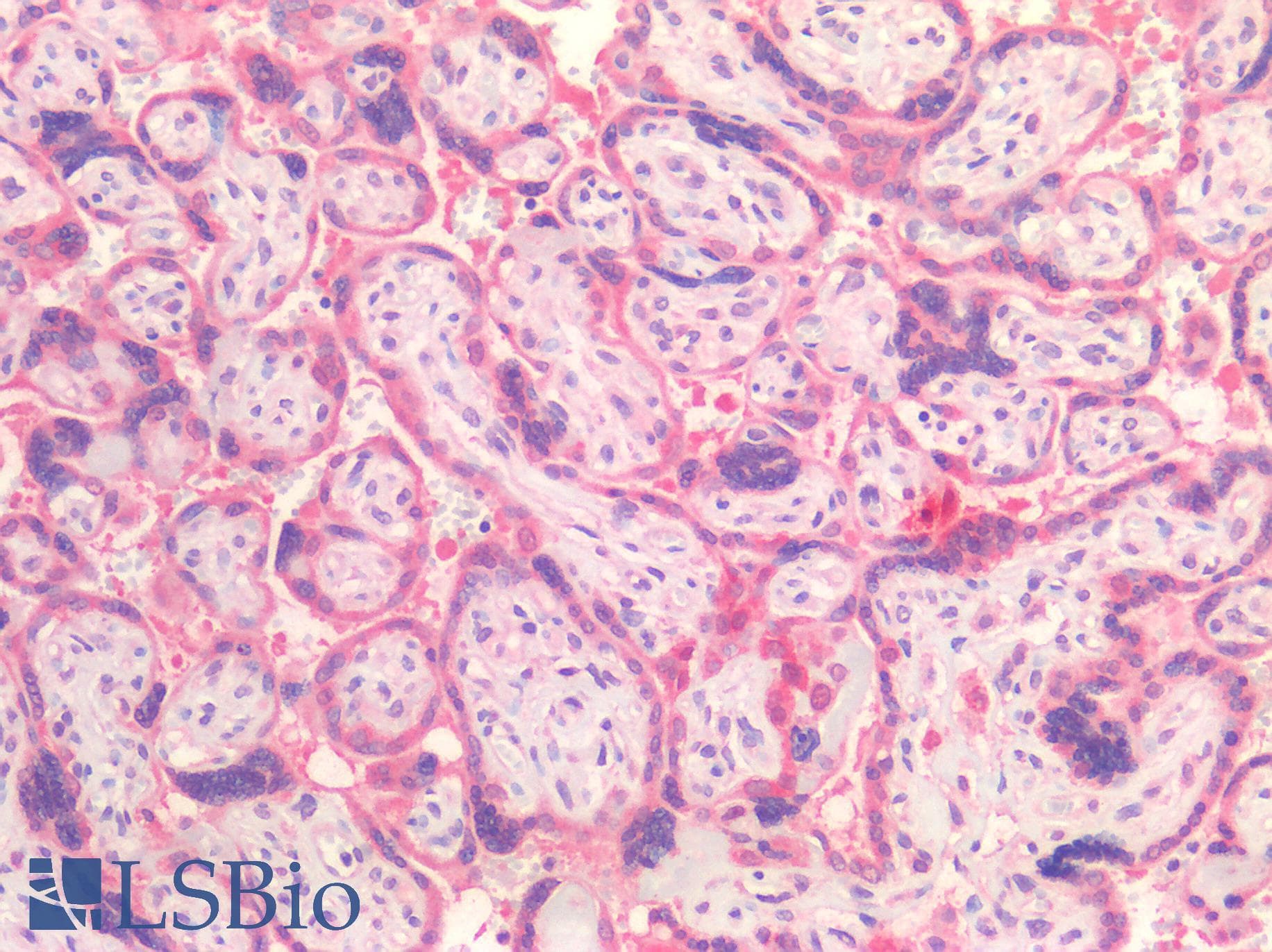 IHC-plus™ Monoclonal Mouse anti-Human IL15RA Antibody (clone 1C5, IHC, WB)