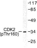 CDK2 Antibody (phospho-Thr160)