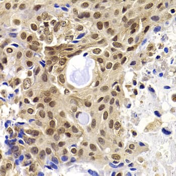 PHF19 Antibody