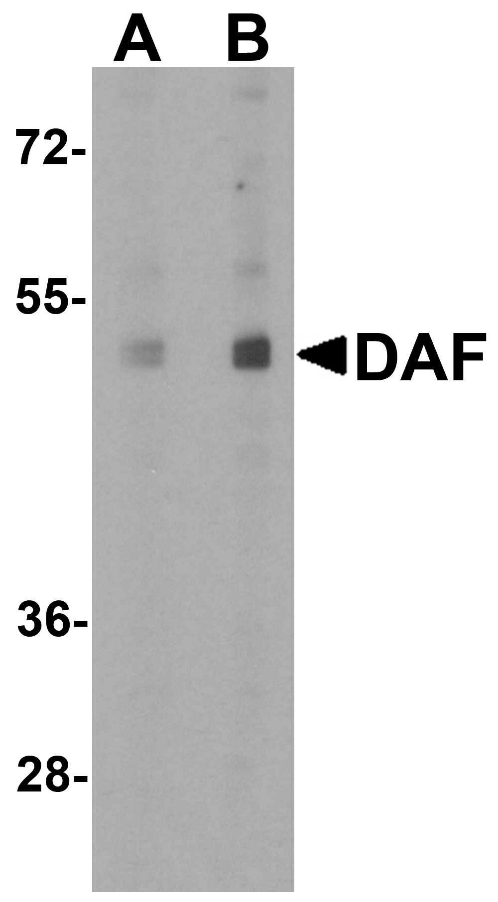 Polyclonal Rabbit anti-Human CD55 Antibody (IHC, IF, WB)