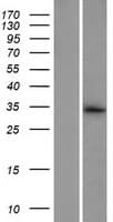 C7orf62 Protein (Over-Expression Lysate Myc-DDK (Flag))