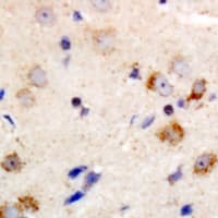 PRKCQ / PKC-Theta Antibody (C-Terminus)