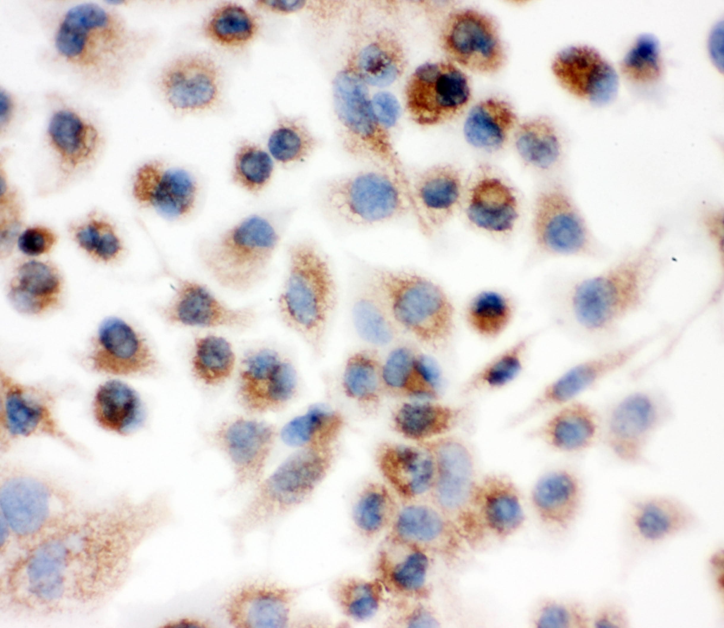 IDH2 Antibody (aa413-447)