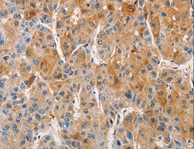PRKCE / PKC-Epsilon Antibody