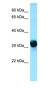 GPM6A / Glycoprotein M6A Antibody (C-Terminus)