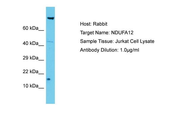 Polyclonal Rabbit anti-Human NDUFA12 / B17.2 Antibody (aa6-55, WB)