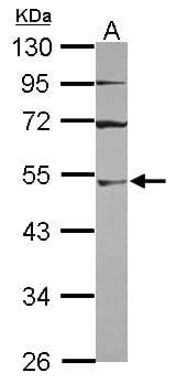 Polyclonal Rabbit anti-Human UBA3 / UBE1C Antibody (WB)
