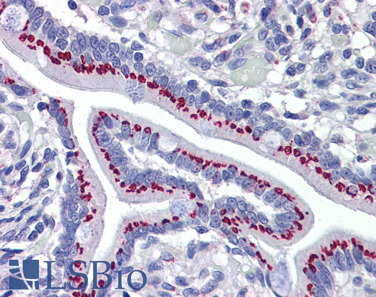 IHC-plus™ GOLM1 / GP73 / GOLPH2 Antibody (clone 5B10)