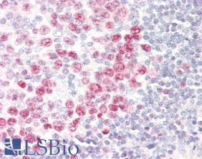 IHC-plus™ DUT / DUTPase Antibody