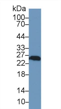 UCHL1 / PGP9.5 Antibody (aa2-223, Biotin)