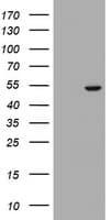 Monoclonal Mouse anti-Human Selenium Binding Protein 1 Antibody (clone OTI3A3, IHC, WB)