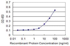 PANK2 Antibody (clone 2B12)