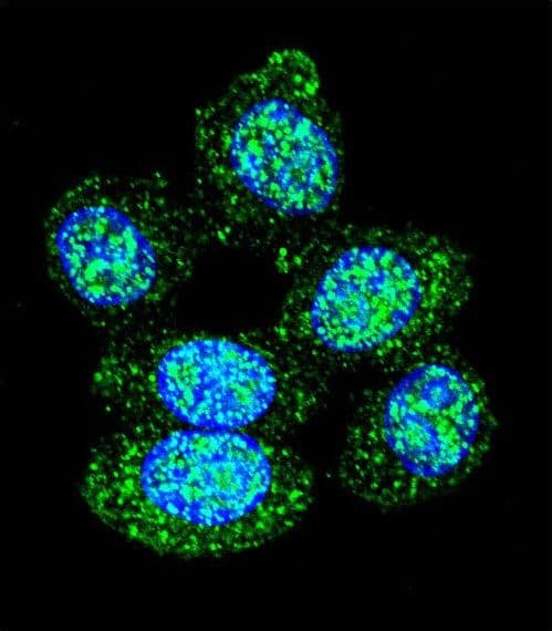 ACP1 / Acid Phosphatase Antibody (aa33-61)