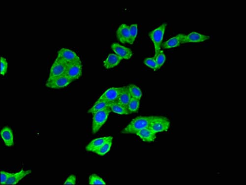 BTRCP / BETA-TRCP Antibody