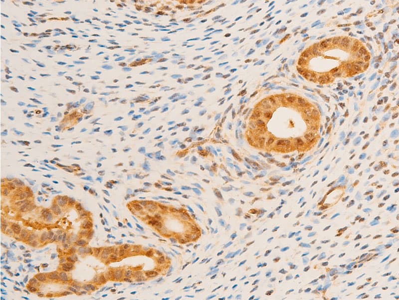 Polyclonal Rabbit anti-Human FOXO3 / FOXO3A Antibody (phospho-Ser253, IHC, WB)