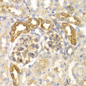 PYCARD / ASC / TMS1 Antibody