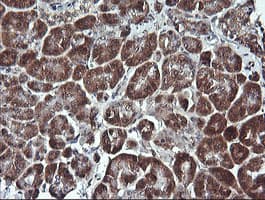 Monoclonal Mouse anti-Human PARVA Antibody (clone OTI3H2, IHC, WB)