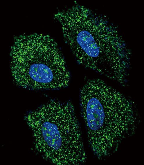 UGT2B15 Antibody (aa156-185)