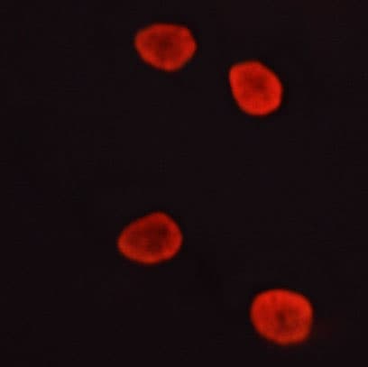 Polyclonal Rabbit anti-Human MAPK3 / ERK1 Antibody (IHC, IF, WB)