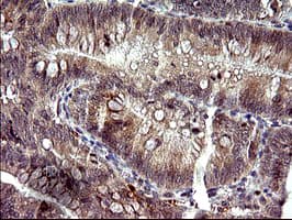 Monoclonal Mouse anti-Human PLA2G16 / HRASLS3 Antibody (clone OTI1A5, IHC, IF, WB)