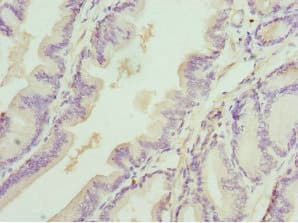 Polyclonal Rabbit anti-Human DEDD Antibody (IHC, WB)
