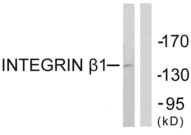 IHC-plus™ ITGB1 / Integrin Beta 1 / CD29 Antibody (aa746-795)