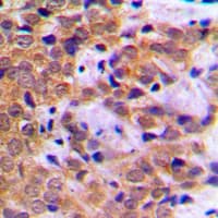 Polyclonal Rabbit anti-Human STAT5A Antibody (phospho-Ser780, IHC, IF, WB)