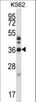 CRKL Antibody (aa50-79)