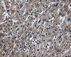 RIP1 / RALBP1 Antibody (clone OTI6G10)