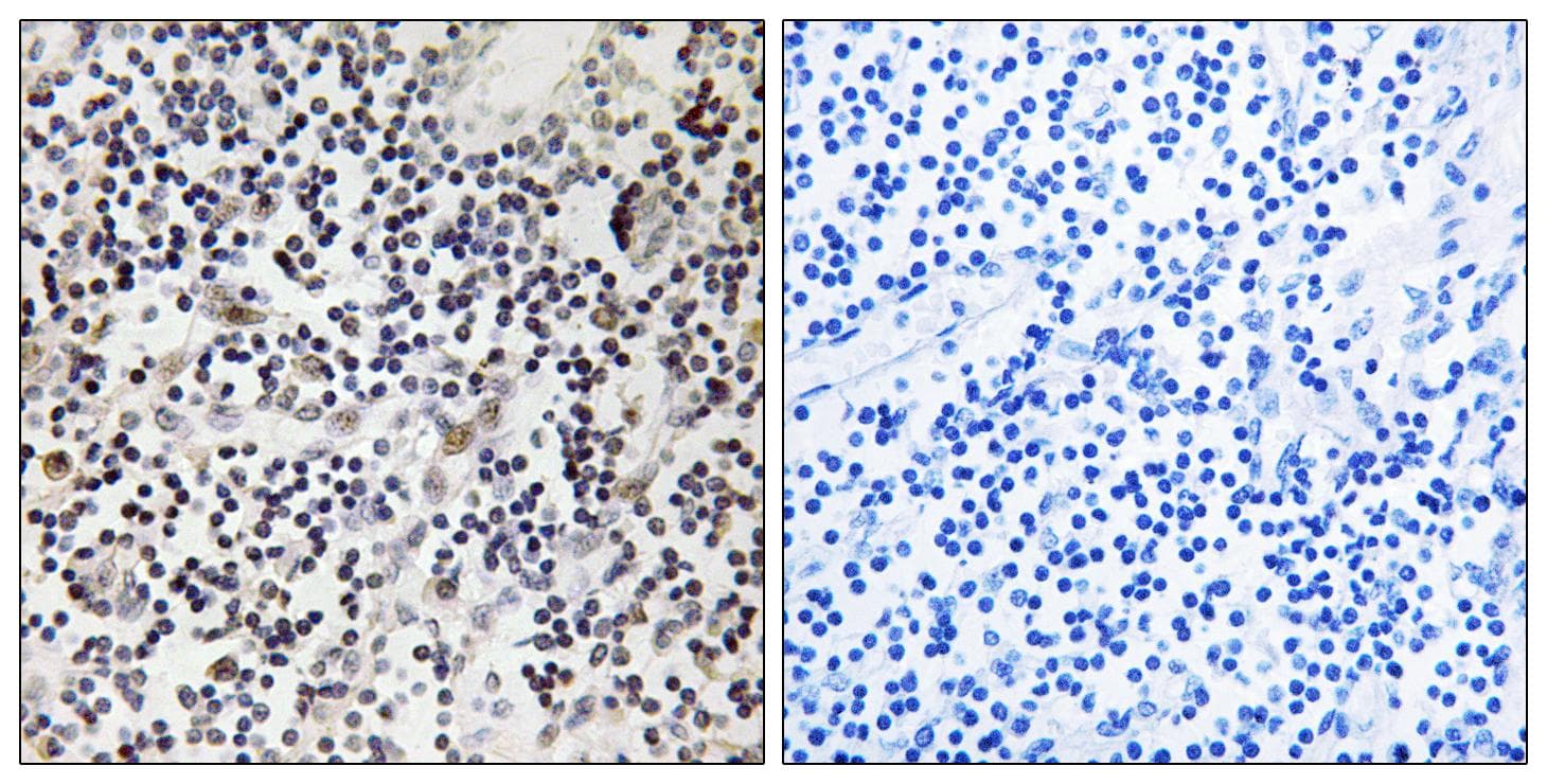 Polyclonal Rabbit anti-Human ESR2 / ER Beta Antibody (phospho-Ser87, IHC)
