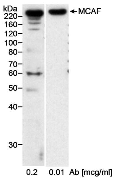 ATF7IP / MCAF1 Antibody (aa25-100)