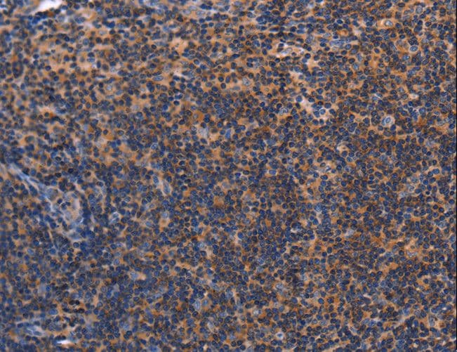 RDX / Radixin Antibody