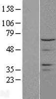 CTDSPL2 Protein (Over-Expression Lysate Myc-DDK (Flag))