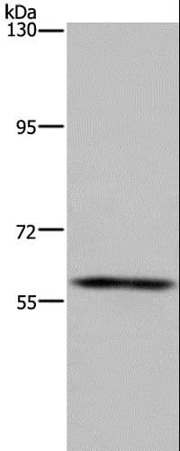 FTO Antibody