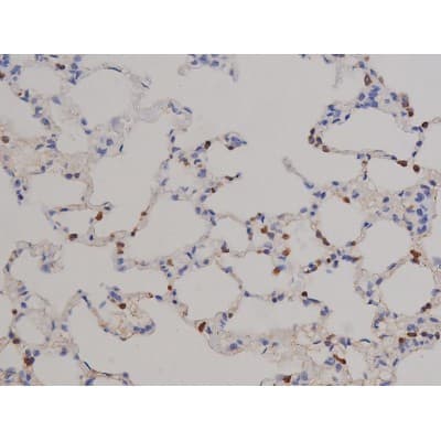 STAT6 Antibody (phospho-Tyr641)