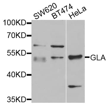 IHC-plus™ GLA / Alpha Galactosidase Antibody (aa150-429)
