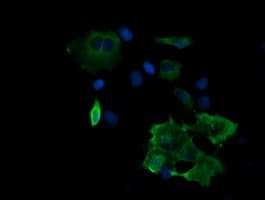 MAP2K2 / MKK2 / MEK2 Antibody (clone OTI5G8)